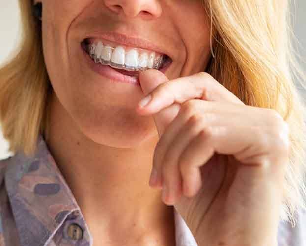 smiling woman holding an Invisalign aligner