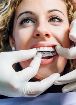 woman getting Invisalign 